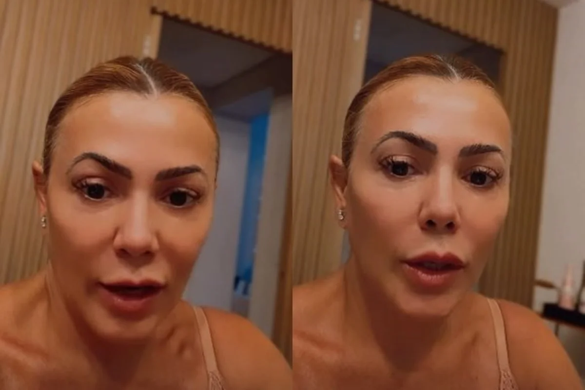 Ex-BBB revela diagnóstico de cisto no cérebro: "Entrei em pânico"