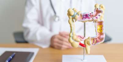 Veja os perigos dos p&oacute;lipos intestinais Foto: Shutterstock / Sa&uacute;de em Dia