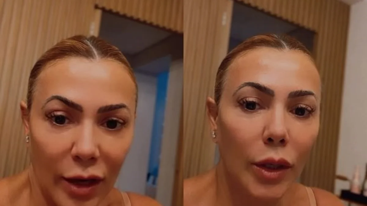 Ex-BBB revela diagnóstico de cisto no cérebro: "Entrei em pânico"