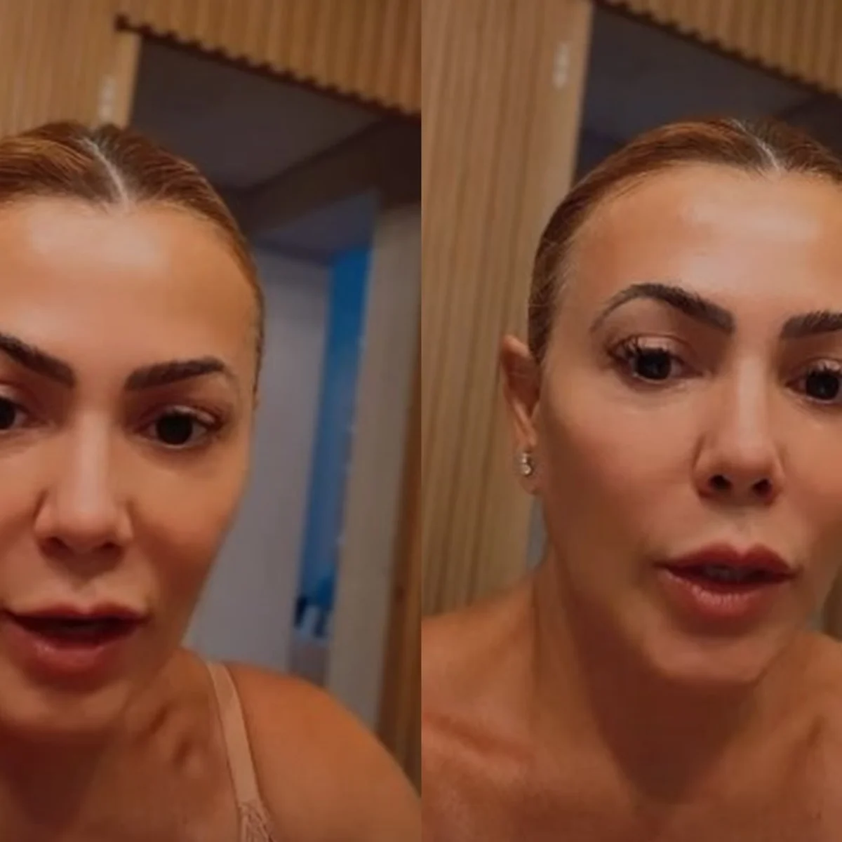 Ex-BBB revela diagnóstico de cisto no cérebro: "Entrei em pânico"