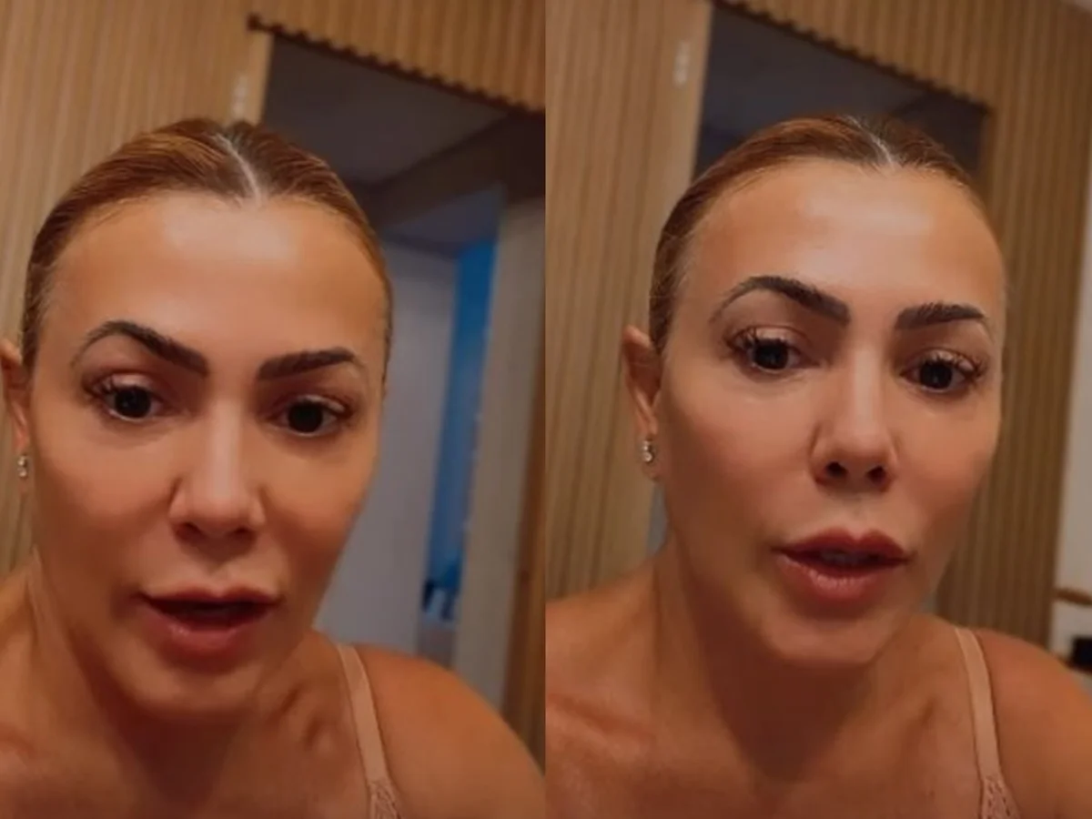Ex-BBB revela diagnóstico de cisto no cérebro: "Entrei em pânico"