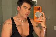 Influencer investe R$ 300 mil em transformação após 20 procedimentos